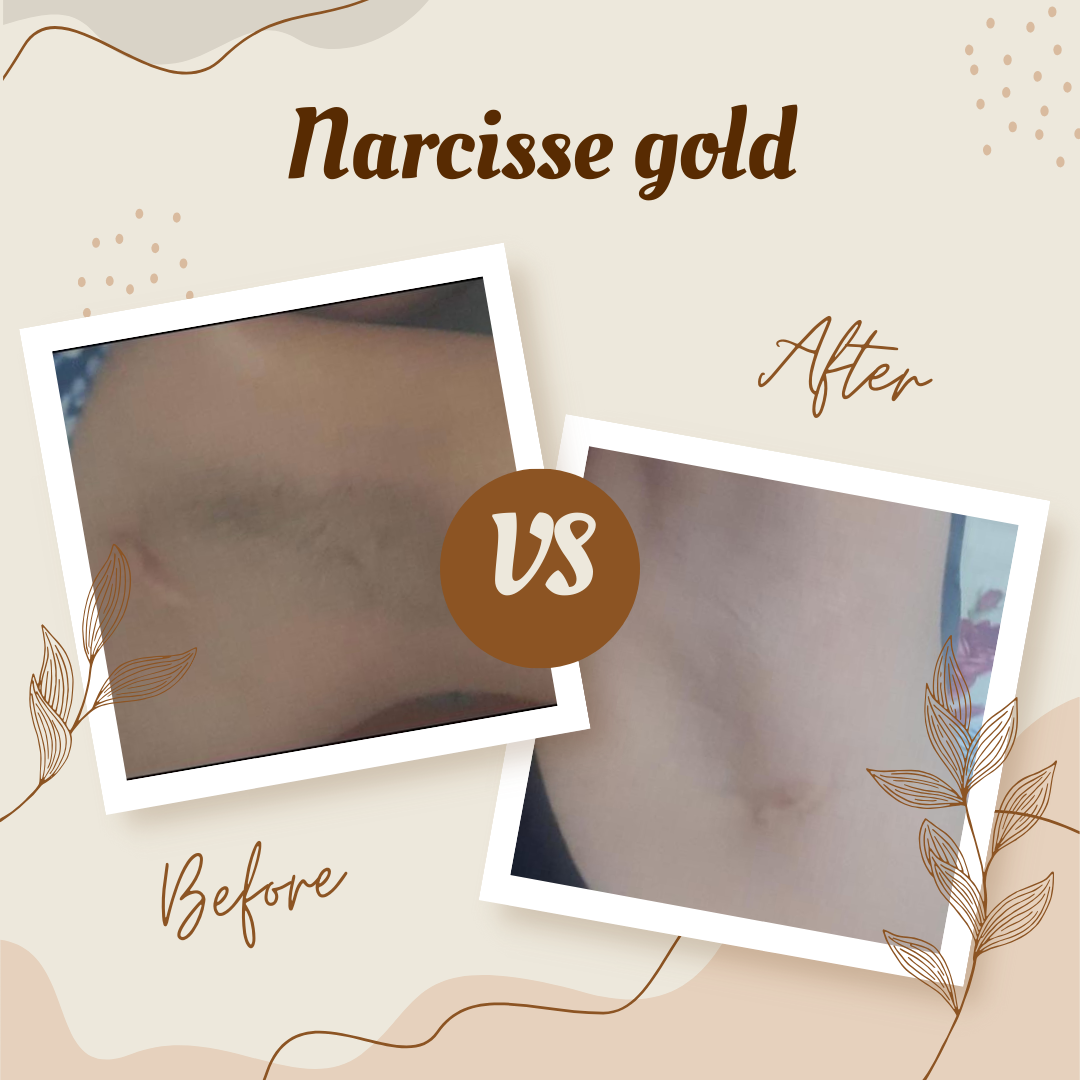 Pack éclaircissant - Narcisse Gold