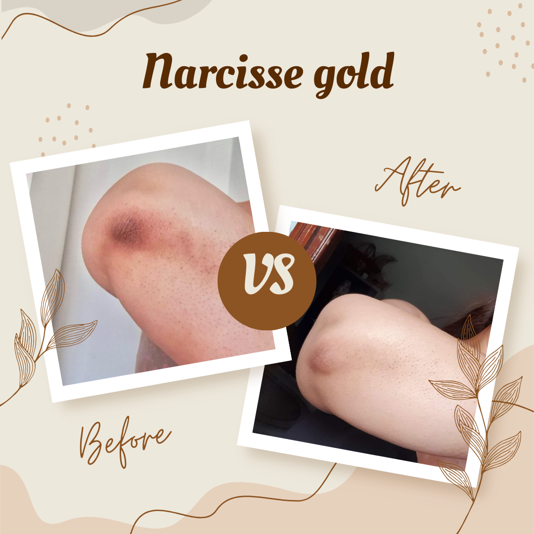 Pack éclaircissant - Narcisse Gold