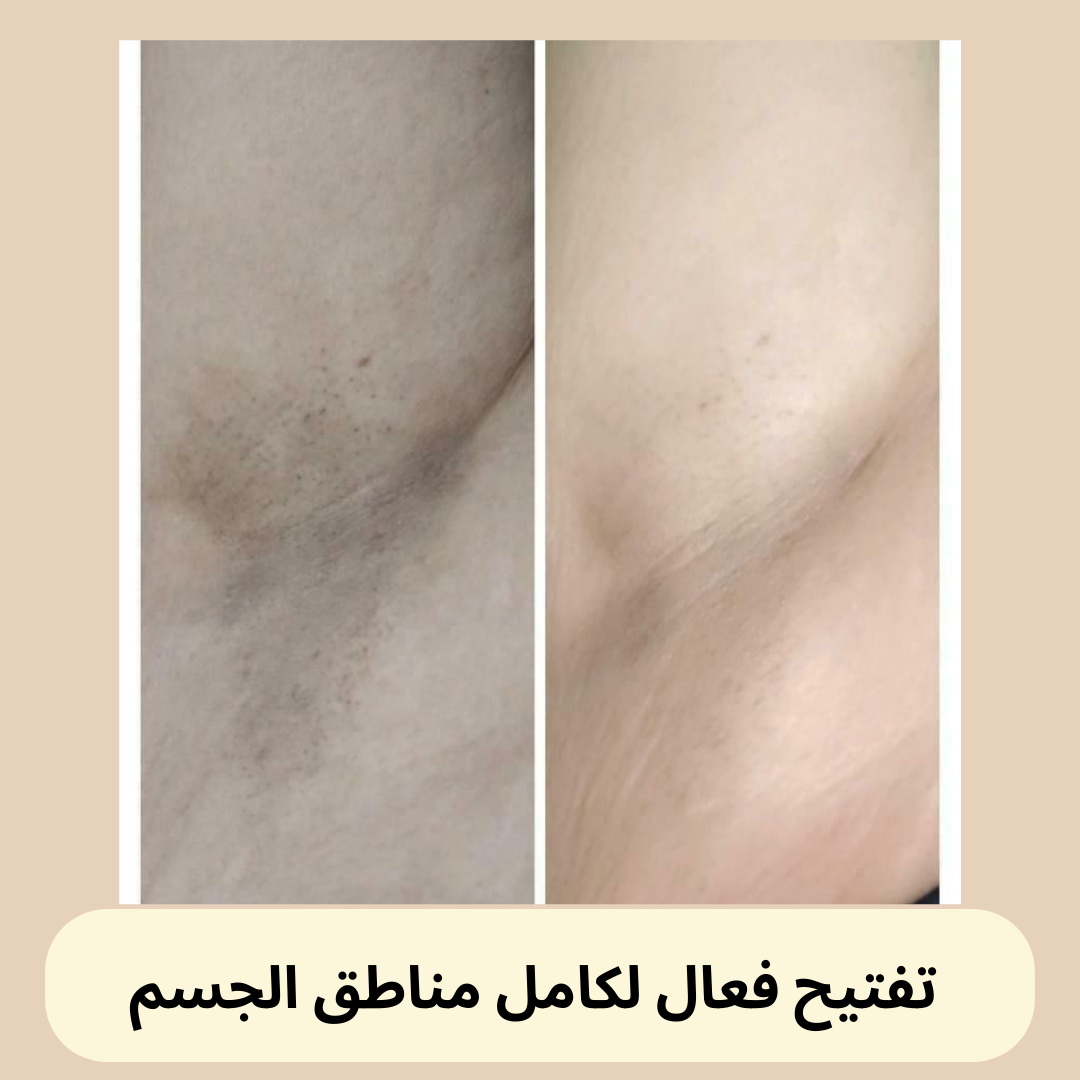 Pack éclaircissant - Narcisse Gold